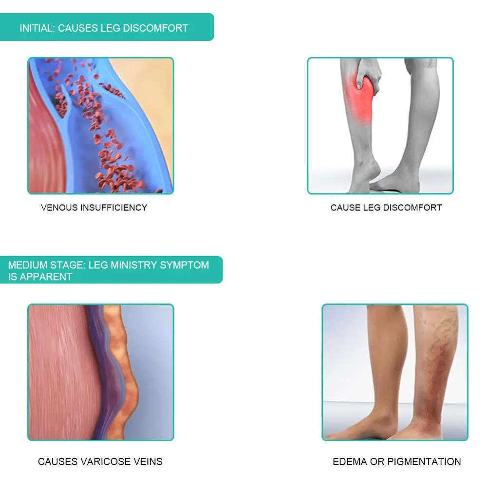 1Pair Medical Compression Sock - Compression Sleeve Calf recension och pris